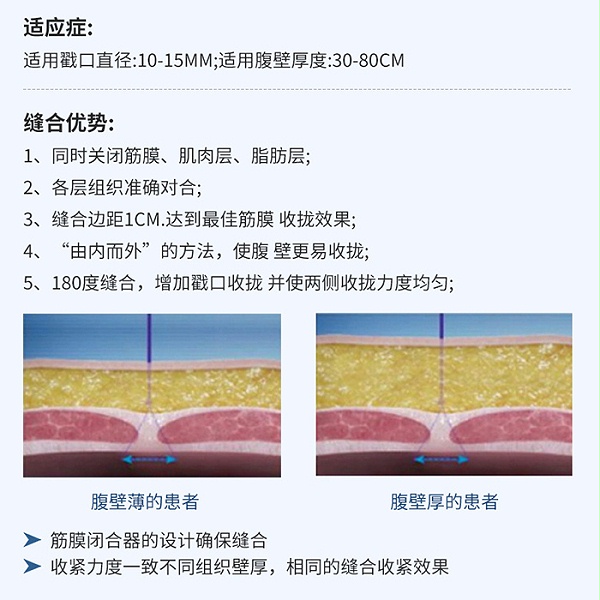 舒扩 一次性使用微创筋膜缝合器