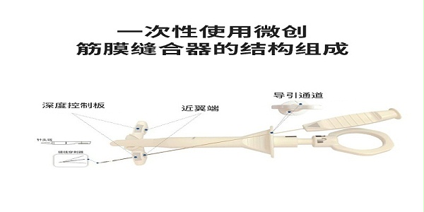 武汉耦合医学一次性微创筋膜缝合器